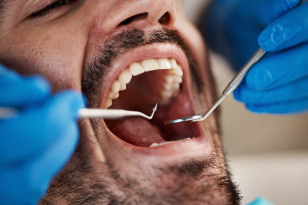 Best Emergency Pediatric Dental Care in North Madison, OH