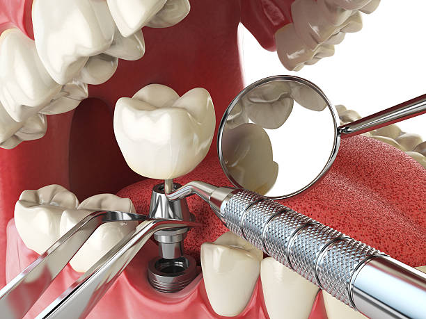 Best Broken or Chipped Tooth Repair in North Madison, OH