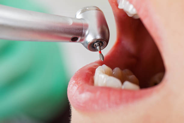 Best Emergency Denture Repair in North Madison, OH